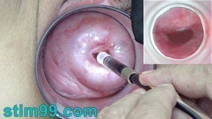 Japanese Endoscope Camera inside Cervix Cam into Vagina